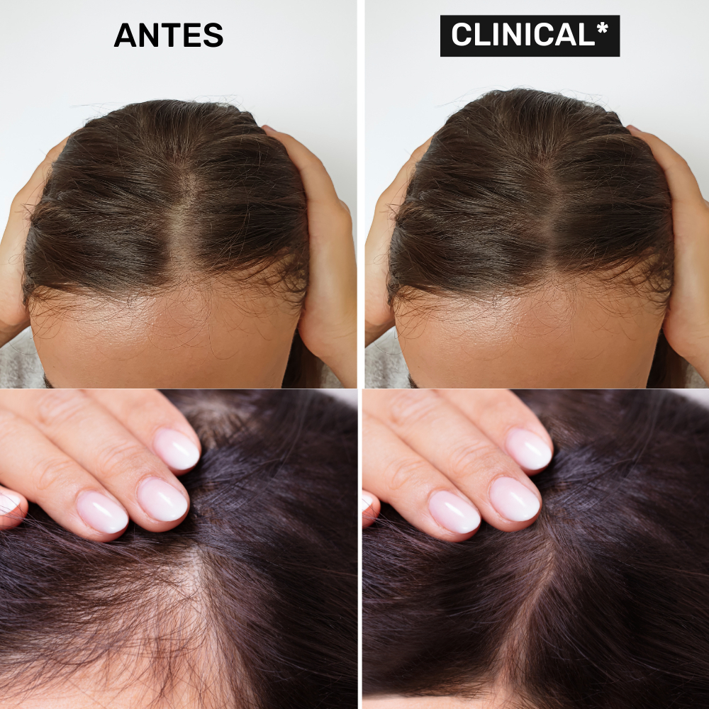 Kit Antiqueda e Fortalecimento - Shampoo (2 unidades) + Balm Capilar (1 unidade) Clinical Gaboni